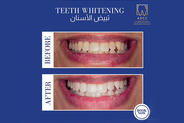 Dr. Mohammed Alaradi  