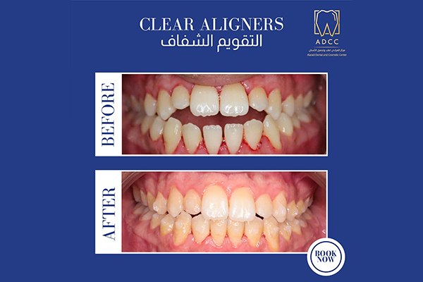 Dr. Mohammed Alaradi  